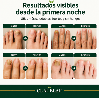 16 Parches Anti-Hongos CLAUBLAR™